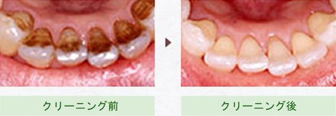 クリーニング前→クリーニング後